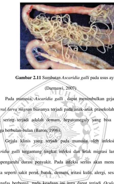Gambar 2.11 Sumbatan Ascaridia galli pada usus ayam  (Darmawi, 2007) 
