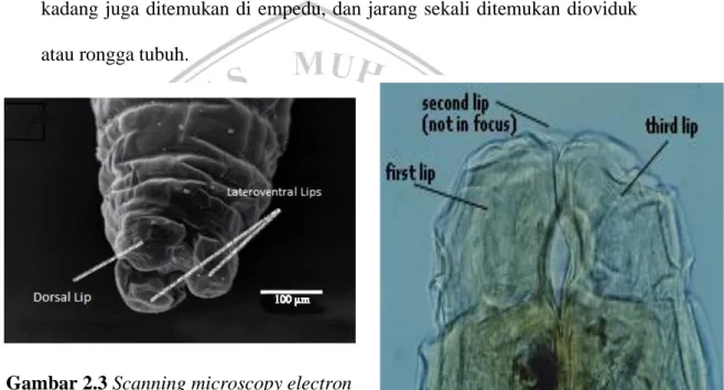 Gambar 2.3 Scanning microscopy electron  Ascaridia galli dewasa bagian anterior 