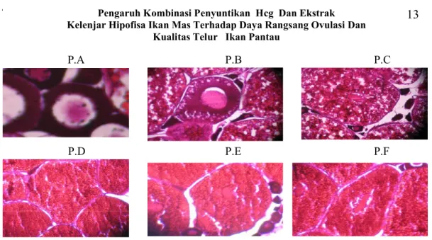 Gambar 5. Histologi  ovarium  ikan  pantau  (Rasbora  lateristrata Blkr)  dari  masing- masing-masing perlakuan 