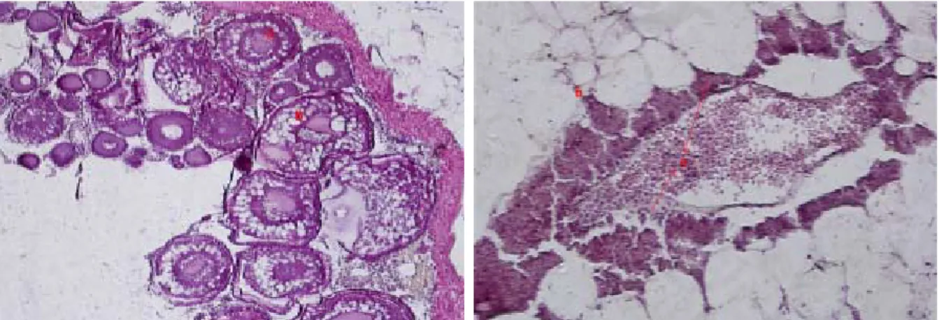 Gambar 3. Fotomikrograf gonad ikan rainbow Sawiat pada perlakuan pH 7,0–8,0 ovarium (kiri) menunjukkan  fully yolked oocyte (a) vacuola, (b) (pewarnaan H&amp;E, 100x), dan testis (kanan) menunjukkan lobus testikular dari tubulus seminiferus (a) mesorchia, 