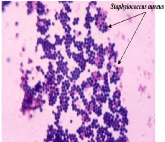 Gambar Staphylococcus aureus perbesaran 1000x  (Todar, 2009) 