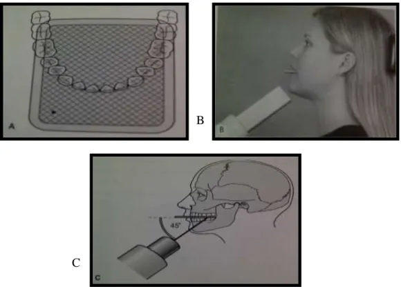 Gambar  2.10  A    Diagram  yang  menunjukkan  posisi  dari  image  reseptor  (menghadap  kebawah)  dalam  kaitannya  dengan  lengkung  rahang  bawah