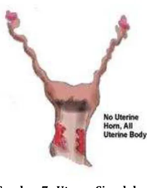 Gambar 7.  Uterus Simpleks  