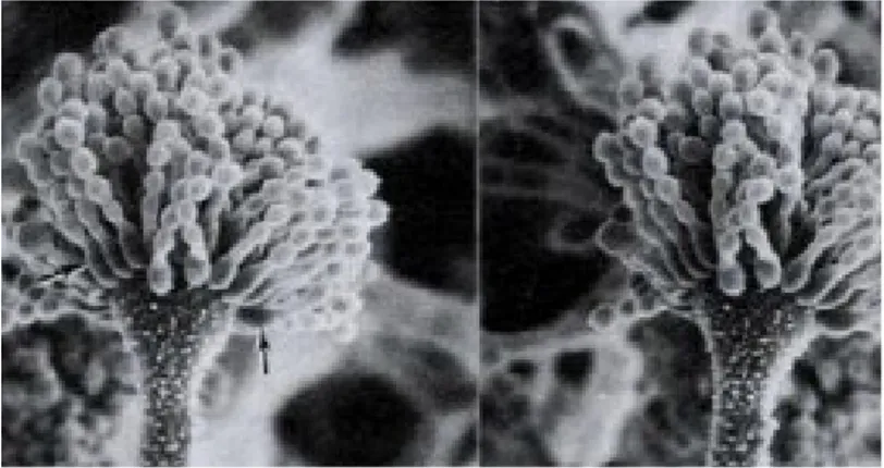 Gambar 1. Aspergillus flavus