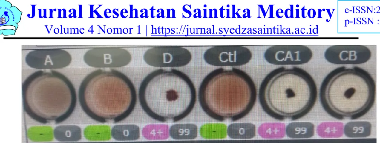 Gambar 5.2 Hasil golongan darah Yang tidak bisa diinterpretasikan pada Metode Microplate Test