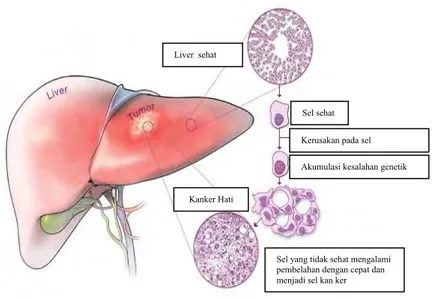 Gambar 4 Mutasi dan proses perkembangan kanker hati (Ren et al. 2003) Karsinogenesis atau proses perkembangan pembentukan kanker terdiri atas  tiga tahapan yaitu inisiasi, promosi dan progresi