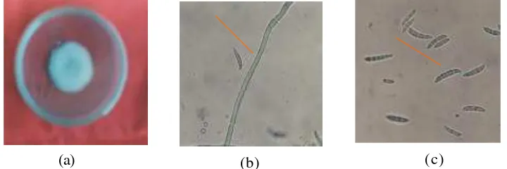 Gambar 2. F. solani.  (a) Koloni pada media PDA berumur empat hari, (b) hifa dan (c) konidia 