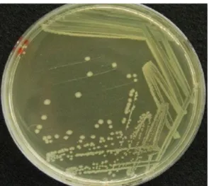 Gambar 3. Escherichia coli pada media Luria agar                   (Sumber : Hedetniemi dan Liao, 2006) 