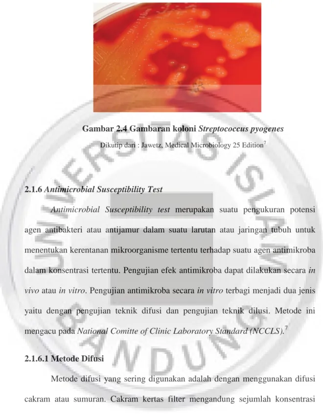 Gambar 2.4 Gambaran koloni Streptococcus pyogenes 