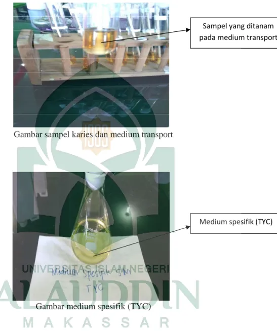 Gambar sampel karies dan medium transport 