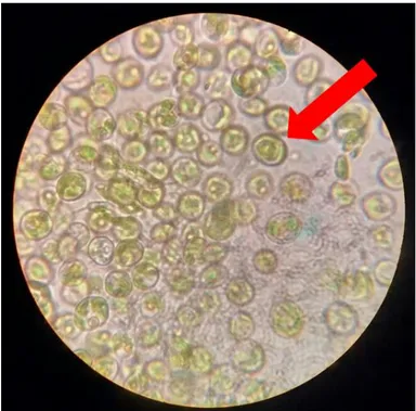 Gambar 4.1. Hasil pengamatan alga dengan mikroskop perbesaran 1600x 