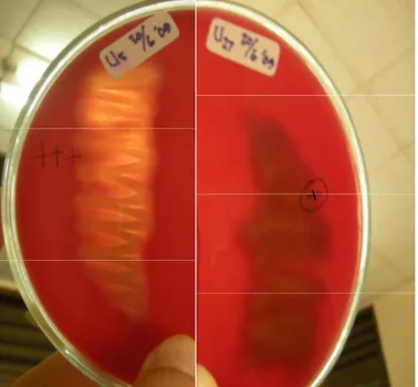 Gambar 4. Hasil uji hemolisis pada isolat-isolat Vibrio  yang ditumbuhkan pada media blood agar.