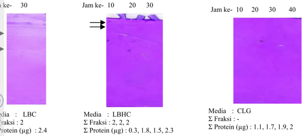 Gambar 10 Hasil zimogram, jumlah fraksi, dan jumlah protein ESM dari isolat B. licheniformis F-11.4 yang  tumbuh pada media LBC dan LBHC