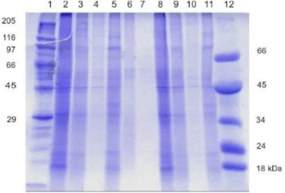 Gambar 1. Contoh Hasil Pita Protein yang Terbentuk 