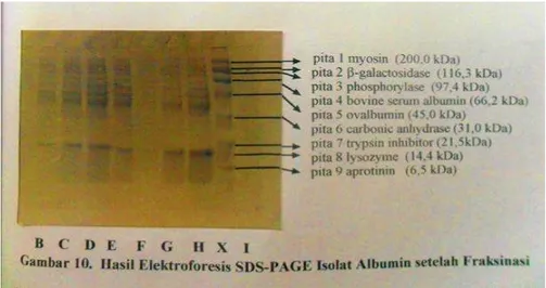 Gambar 2. Hasil Elektroforesis SDS-PAGE Isolat Albumin setelah Fraksinasi