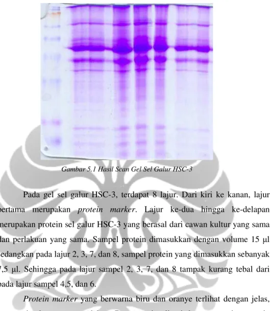 Gambar 5.1 Hasil Scan Gel Sel Galur HSC-3 
