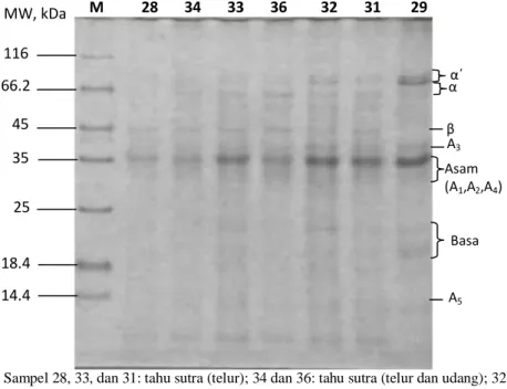 Gambar 13. Profil SDS-PAGE total protein tahu berdasarkan chewiness    