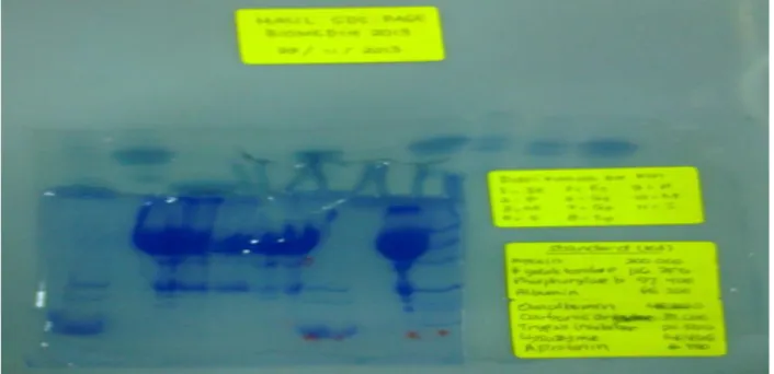 Foto Hasil Elektroforesis SDS-PAGE darah  Keterangan : 