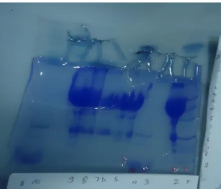 Foto Hasil PCR dan Elektroforesis Polyacrilamide Gel 