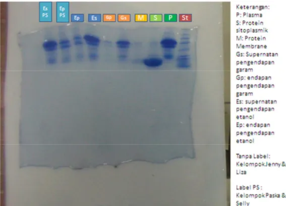 Gambar 3. Foto Hasil PCR dan Elektroforesis Polyacrylamide Gel