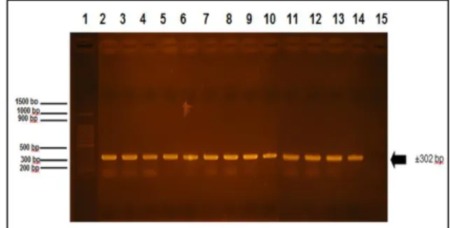 Gambar 1. Hasil Elektroforesis DNA (1) Marker 1 kb  (2) DNA Genom S. typhi, (3) S. typhimurim, (4) E