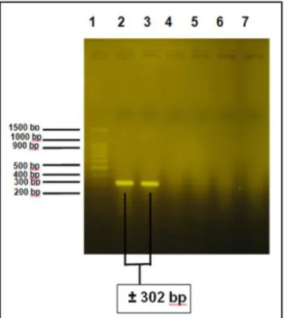 Gambar  6.Hasil  Amplifikasi  dengan  Pasangan  Primer  Gen  HSP70-2.  (1)  Marker  DNA,  (2)  Hasil  PCR  DNA  Genom  S