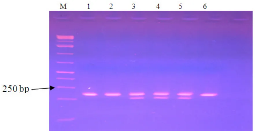 Gambar 1 juga menunjukkan hasil amplifikasi  PCR pada 5 subjek studi. DNA hasil amplifikasi  adalah DNA dari alel -786T&gt;C dengan panjang  fragmen  236  bp