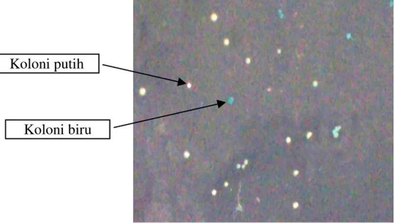 Gambar 7  Seleksi biru putih koloni E. coli DH5α yang ditransformasi dengan hasil ligasi antara  DNA  plasmid  pGEM ® –T  Easy  dan  GmMt2  pada  media  seleksi  yang  mengandung  ampisilin, IPTG dan X-gal