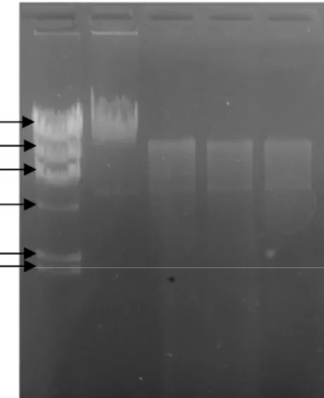 Gambar IV. 5   Elektroforegram pemotongan secara parsial DNA kromosom  Vibrio sp. SFNB3 oleh enzim restriksi EcoRI dengan variasi  aktivitas unit enzim restriksi