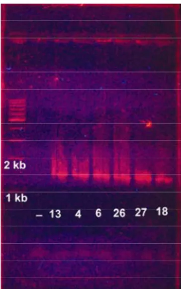 Gambar 1.8  Elektroforesis Produk PCR 16S rDNA. Tanda 1 kb dan 2 kb menunjukkan  marka 1 kilo basa dan 2 kilo basa