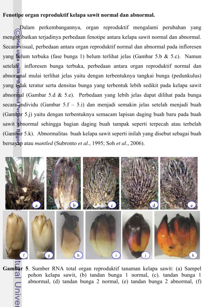 Gambar 5. Sumber RNA total organ reproduktif tanaman kelapa sawit: (a) Sampel  pohon kelapa sawit, (b) tandan bunga 1 normal, (c)