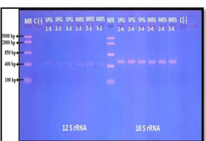 Gambar 8. Elektroforegram Hasil Amplifikasi III  16s rRNA 