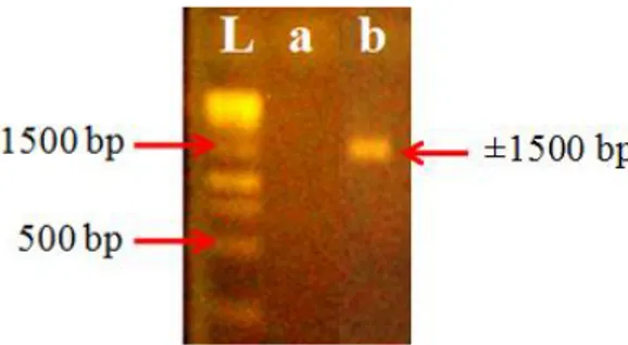 Gambar  1.  Profil  pita  DNA  hasil  optimasi  Taq  PCR. 