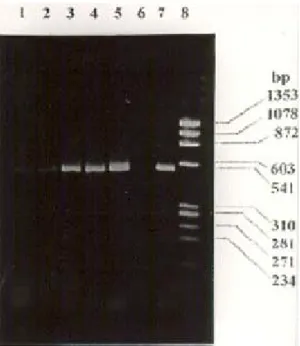 Gambar 1. Hasil amplifikasi DNA M. tuberculosis isolat IMt 3  dengan metode PCR dan elektroforesis gel agarosa