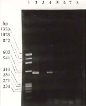 Gambar 3. Hasil amplifikasi DNA mikobakteria atipik  dengan metode PCR dan elektroforesis gel agarosa.