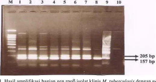 Gambar 2. Hasil amplifikasi bagian gen rpoβ isolat klinis M. tuberculosis dengan nested PCR dalam gel agarosa 1,5%