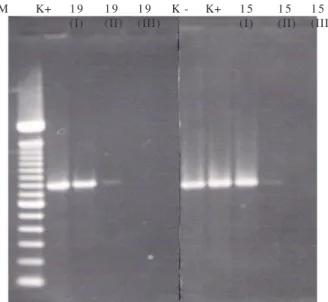 Tabel 2. Hasil  Deteksi  Gen  kas-A  pada  DNA  Sputum  BTA Positif yang  Diekstraksi  dengan 3  Macam  Metode, Menggunakan Teknik PCR