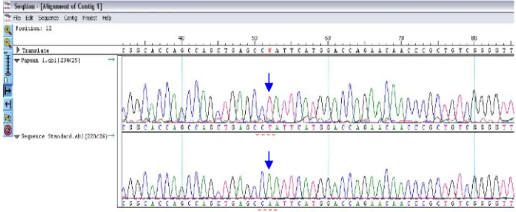 Gambar 2.  Penjajaran (alignment) SeqMan TM DNASTAR. Tampak pada gambar komplemen urutan nukleotida isolat P1 (P1-RR)  disejajarkan dengan komplemen urutan nukleotida galur standar M