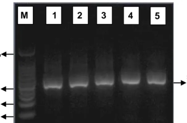 Gambar  1.  Elektroforegram  hasil  amplifikasi  isolat  H37Rv  dan  134;  M  :  marker  DNA  100  pb;  1-3  :  isolat  H37Rv;   