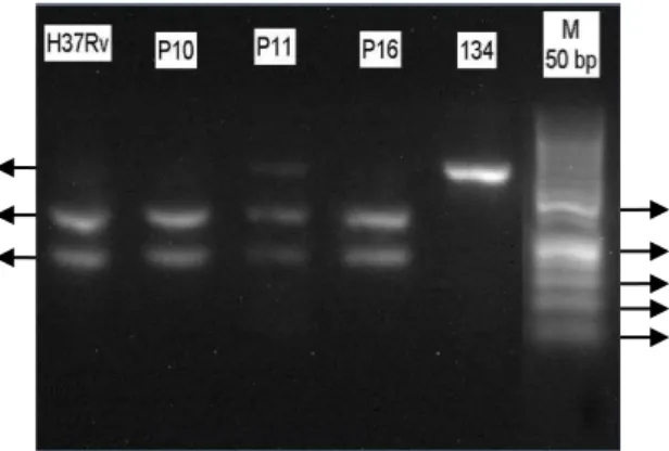 Gambar  3.  Elektroforegram  hasil  digesti  produk  PCR;  M  :  marker  DNA  50pb; 