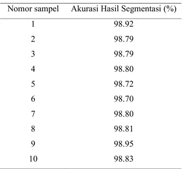 Tabel 3.2. Hasil Pengujian Akurasi Segmentasi Iris Mata. 