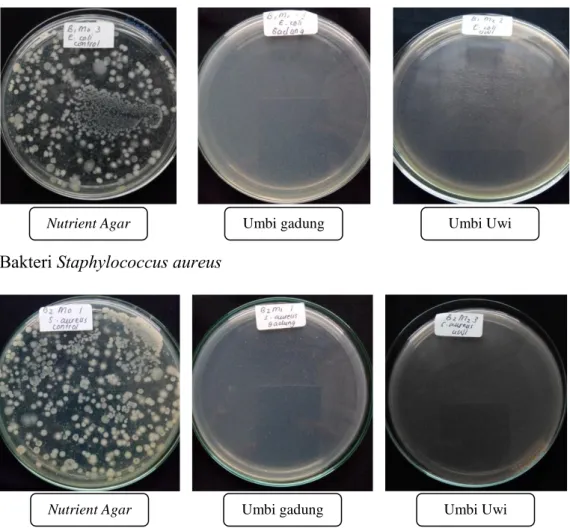Gambar 1 Pertumbuhan Koloni Escherichia coli dan Staphylococcus aureus pada media Nutrient  Agar (kontrol), media umbi gadung,dan media umbi uwi inkubasi 24 jam 