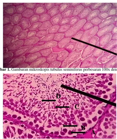Gambar 2. Gambaran mikroskopis tubulus seminiferus testis perbesaran 400x dengan pengecatan HE