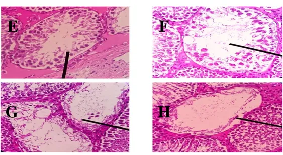 Gambar 4. Gambaran mikroskopis tubulus seminiferus dalam penilaian kriteria skor Johnsen  perbesaran 400x dengan pengecatan HE