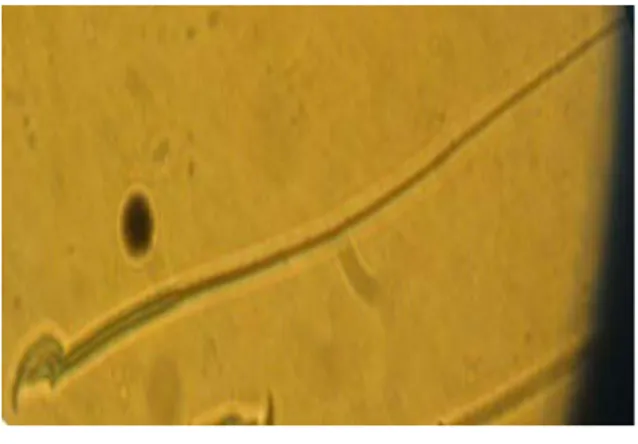 Gambar 1. Spermatozoa mencit yang normal 