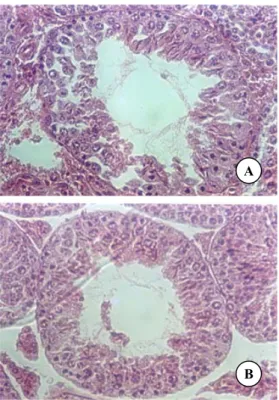 Gambar 3.  A.  Struktur tubulus seminiferus mencit kelompok  perlakuan II (dosis 200 mg/kg BB/hari)