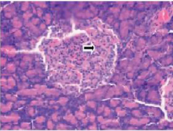 Gambar 8. Pankreas tikus wistar albino (H+E Stain, x 400) menunjukkan infiltrasi  sel limfosit pada pulau Langerhans (Sumber: Meo et al., 2010)