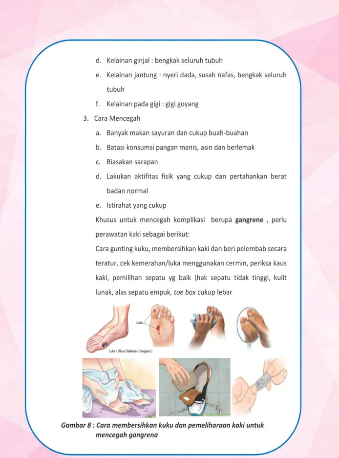 Gambar 8 : Cara membersihkan kuku dan pemeliharaan kaki untuk                        mencegah gangrena 