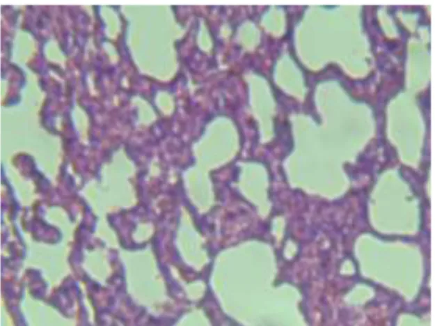 Gambar 5. Gambaran mikroskopis alveolus tikus putih pada kelompok perlakuan PA  (perbesaran 400x) 