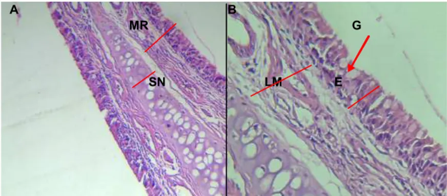Gambar 2. Histologi Mukosa Respiratorius Kelompok Kontrol (A) Mukosa Respiratorius pada Septum Nasal Perbesaran 100x
